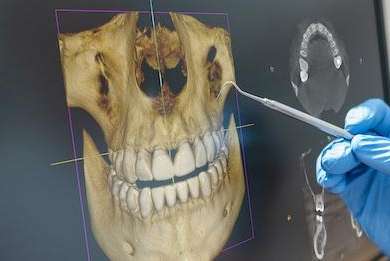 3-D Cone Beam Computed Tomograhy